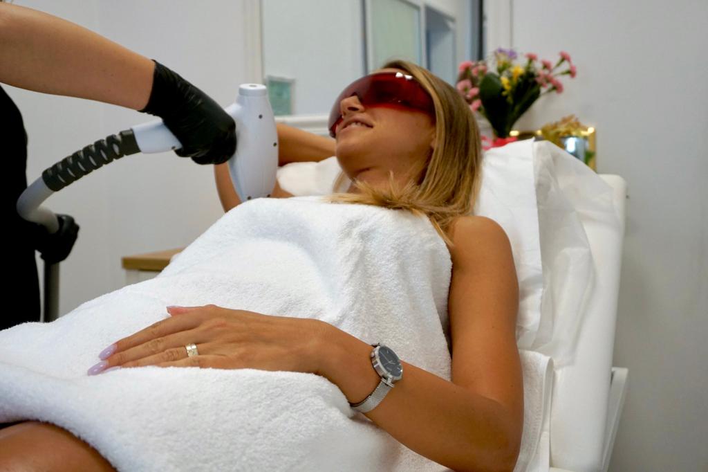 Epilare definitiva laser axila
